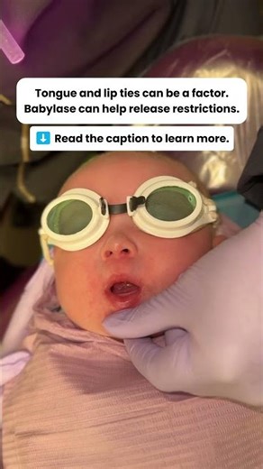 Do you want to know why some babies struggle with latch or feeding?