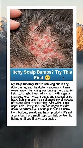 Itchy Scalp Bumps? Try This First 😖