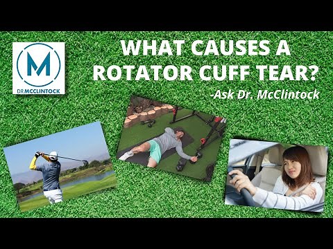 What Causes a Rotator Cuff Tear? | | Dr. Kyle McClintock