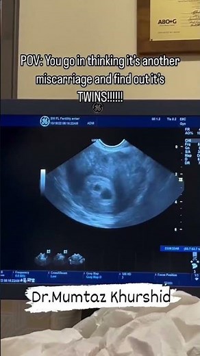Twin Pregnancy Ultrasound Scan