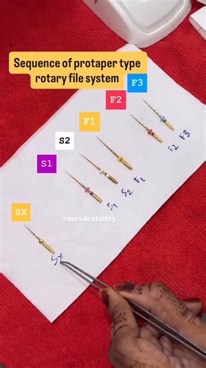 Dr. Zainab | Dentist 🦷 on Instagram: "🔷 BASIC SEQUENCE OF ROTARY FILES & THEIR USES 1️⃣ Orifice Opener / SX Use: • Enlarge coronal third • Remove cervical dentin interferences • Improve straight-line access • Reduce stress on apical files 📌 Used first after access opening 2️⃣ Shaping Files (Coronal & Middle Third) 👉 Examples: S1, S2 (ProTaper) Use: • Shape coronal and middle third • Create smooth taper • Facilitate deeper file penetration • Allow better irrigation 📌 Used after glide path 3️