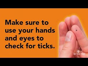 Know how to do tick checks