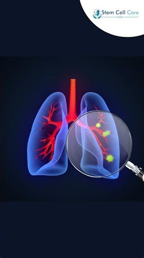 COPD Awareness: Breathing Better with Stem Cell Therapy | Lung Disease | Regenerative Medicine |