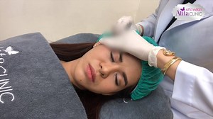 โปรแกรม Mini Face Lift 7 นาที By หมอนุ่น รีวิวเคสคนไข้จริงที่เข้าโปรแกรม ปรับรูปหน้า และแก้ปัญหาจุดต่างๆ แบบทีเดียวจบ !!! ✅เห็นผลลัพธ์ที่ดีขึ้นหลังทำทันที ✅ไม่ต้องผ่าตัด ✅ไม่บวม ไม่ต้องพักฟื้น ✅ใช้เข็มทู่ ไม่ตัดเส้นเลือด #คอมเม้นปรึกษาการปรับรูปหน้าได้เลยค่ะ #ปรึกษาฟรีไม่มีค่าใช้จ่าย กด HD รับชมคลิปที่ชัดยิ่งขึ้นนะคะ สนใจสอบถาม ทักแชทได้เลยค่า Facebook : m.me/ATITAClinicCentre Line : https://line.me/R/ti/p/@atitaclinic Call Center 094-324-4442 085-289-3777 086-799-9669 #FacialDesignbyDrนุ่น | AT