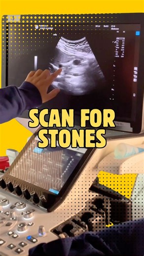 Gallbladder Ultrasound: Understanding RUQ Pain