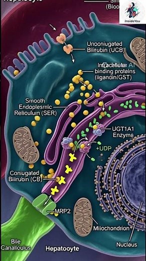 What is Huntington's disease? #medicine #biology #science