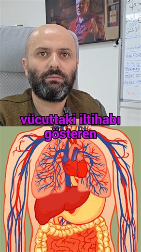 Nur Osman Acar on Instagram: "💬 YAZışMAK İSTEYENLER >>> WHATSAPP 0501 083 1032 + 0543 297 9165 ☎️KONUŞMAK İSTEYENLER >>> 0246 502 1532 🌿 Bugün başla > yarın farkı hisset !🌿 📞 AHMET MARANKİ KOZMİK YAŞAM MERKEZİ ISPARTA Bilimsel kaynaklar: Effect of curcumin on C-reactive protein as a biomarker of systemic inflammation https://onlinelibrary.wiley.com/doi/epdf/10.1002/ptr.7284 Wiley Online Library Oral turmeric/curcumin effects on inflammatory markers in chronic infl
