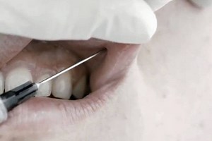 Antiviral: official trailer