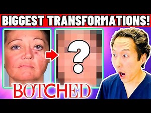 Plastic Surgeon Reacts to BOTCHED: The Most AMAZING Transformations!
