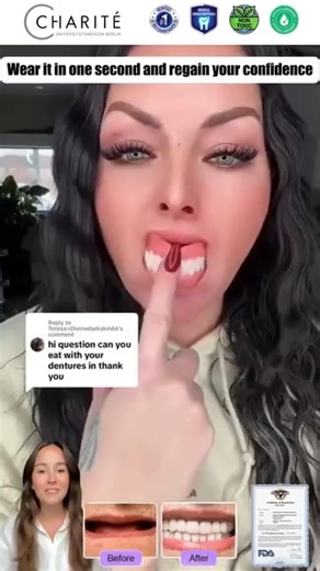 Tired of dentures that slip, rub, or make eating feel like a chore? You’re not alone — and dental experts agree it’s time for something better. 🩺 “Traditional dentures often cause bone loss and facial sagging.” — 𝘿𝙧. 𝙇𝙖𝙧𝙧𝙮 𝙍𝙖𝙨𝙚𝙣𝙩𝙝𝙖𝙡, 𝘿𝘿𝙎 That’s why the Advanced Customized Full Denture Set is changing the game. ✨ Custom, stable fit — no more slipping ✨ Supports your facial shape ✨ No messy adhesives ✨ Ultra-natural look ✨ Highly rated by 84,000 users This isn’t another bulky, 