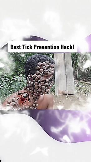 The Best Tick Prevention Hack! 1. Best Tick Prevention for Humans 2. Stay Tick-Free 3. The Dangers of Ticks 4. Avoid Tick Hotspots #tickprevention #tickpreventiontips #tickinformation #tickidentification #ticks