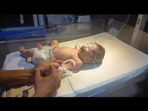 IV Lines 💉 Protocol & Management: A Step-by-Step Guide#IV lines #babycare #youtubevideo #cutebaby