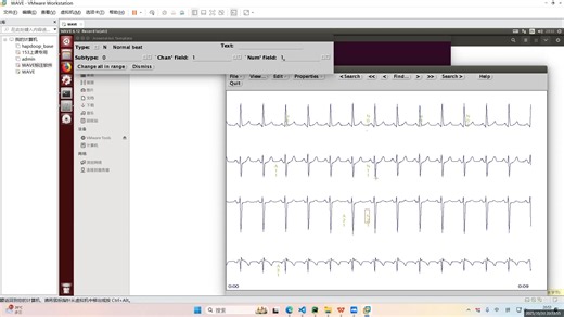 WAVE使用教程：以ECG为例