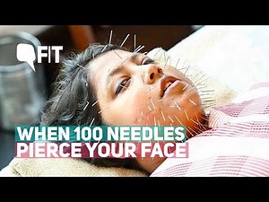Cosmetic Acupuncture: I Got 100 Needles Pierced on my Face for Beauty | Quint Fit