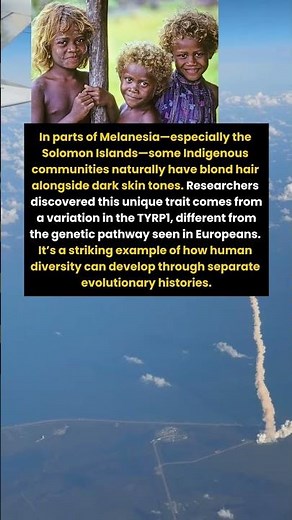 Why Some Melanesians Have Natural Blond Hair