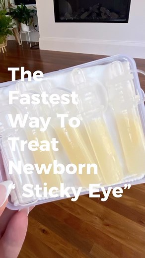 10K views · 137 reactions | Did your newborn experience “ sticky eye...