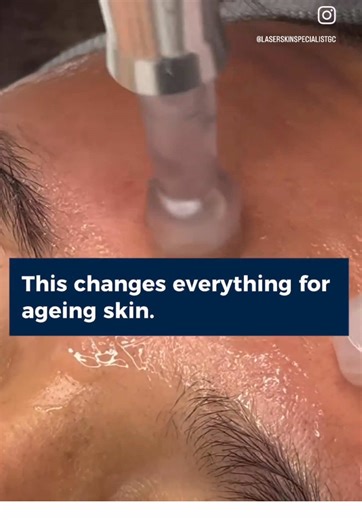 ❤️‍🔥 This changes everything for ageing skin. ❤️‍🔥 New. Advanced. Regenerative. What if one treatment could: Rapidly reduce redness post needling Supercharge your collagen production Visibly rewind the signs of ageing Accelerate skin healing like never before? Meet Exosomes: the next evolution in skin science. They’re not just growth factors, they’re cellular messengers that tell your skin how to repair, regenerate and glow again. We’ve paired them with our most advanced treatments for dramati