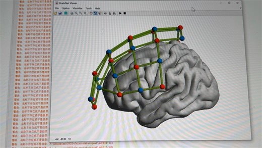 BrainNet viewer使用
