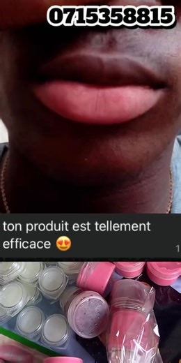 Comment utiliser le kit lèvres roses efficacement