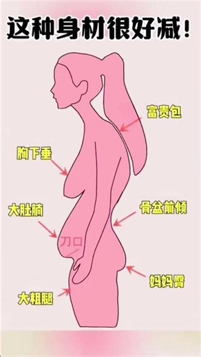 Unlock Perfect Posture: Chest Expansion & Back Beautification Workout