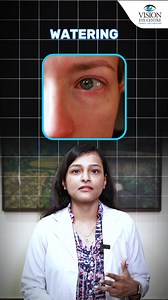 Curious about glaucoma’s side effects? Dr. Rwituja Thomas Grover explains that untreated glaucoma can cause vision loss, headaches, and eye pain. Early treatment is key! Got questions? Drop them below! #Glaucoma #EyeHealth #VisionCare #DrRwitujaThomasGrover #HealthyVision | Vision Eye Centre | Facebook