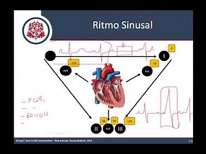 ¿Como interpretar cualquier Electrocardiograma?