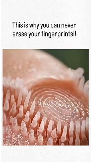 unique Finger prints #medicaleducation #fingerprint