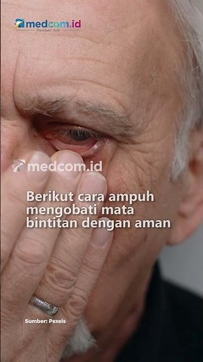CARA AMPUH MENGOBATI MATA BINTITAN