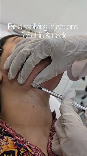 Fat dissolving injections for chin and neck results