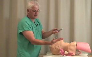 气管插管- Direct Laryngoscopy - MICU Fellows Airway Course