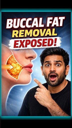 Buccal Fat Removal Myths vs Reality #factsonly #beauty