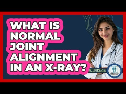What Is Normal Joint Alignment In An X-Ray?
