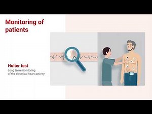 How does the ECG analysis look like with AI?