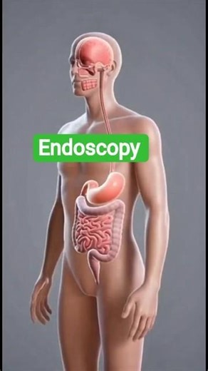 Endoscopy Explained in 3D | Inside the Digestive Tract 🔬 | #Shorts #3danimation