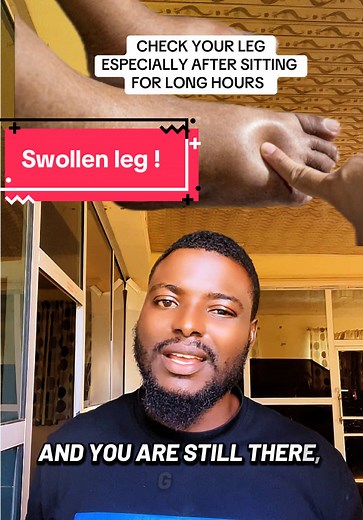 Understanding Swollen Legs and Health Risks