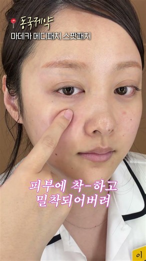 제가 꾸준히 추천하고 있는 스팟 패치!!병풀 명가 제약사에서 만든 인생 패치..💗