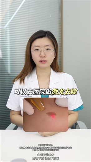 孩子身上的斑都是什么？皮肤科医生一条视频说清楚！胎记鹤吻痕蒙古斑血管瘤咖啡斑