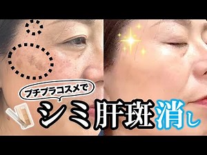 [Secret trick to remove dark spots and liver spots] Combining these two affordable cosmetics will...