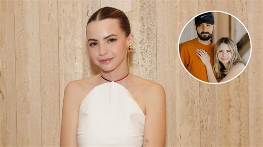 Bobbi Althoff Says Her Face is Paralyzed After “Botched” Botox