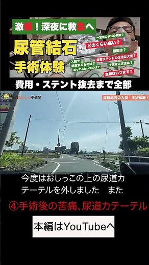 尿管結石のカテーテル抜去がヤバい… #尿管結石 #手術体験 #入院生活