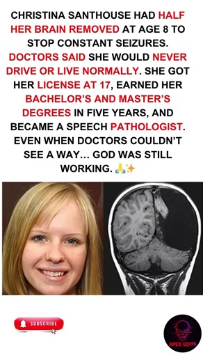 🙏Half her brain removed Became a speech pathologist💪🧠#Miracle #Inspiring #BrainSurgery #shorts #g