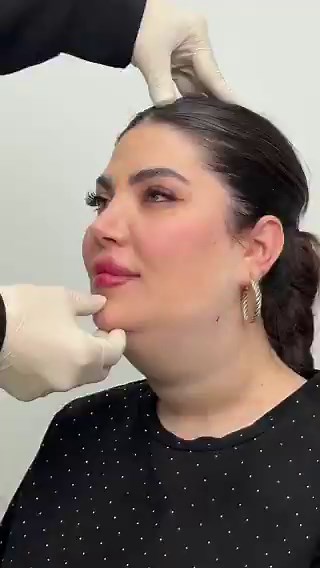 This is gender affirming care and this is praised but if trans folks do the same it's demonised.