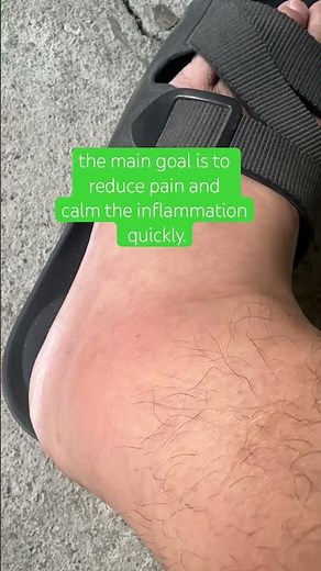 What To Do On The First Day Of Gout Attack? #gout #uricacid #goutawareness