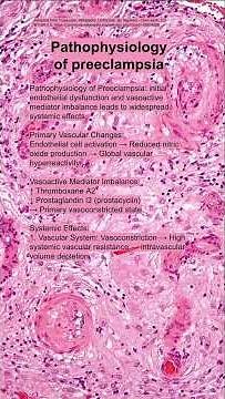 Pathophysiology of preeclampsia