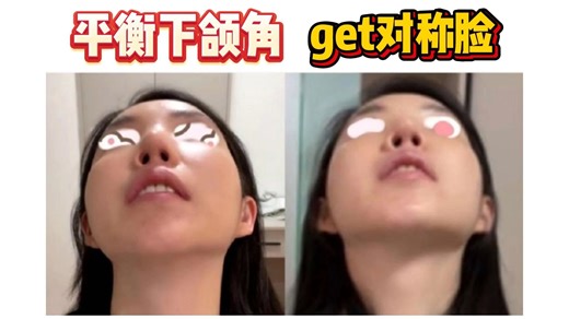 平衡下颌角，get对称脸