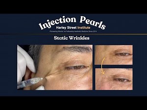 Beyond Botox: Elevating Crow’s Feet Results with Layered Filler Techniques | Aesthetic Medicine