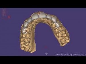 Exocad : Designing Mockup - Veneers for a Dental Lab
