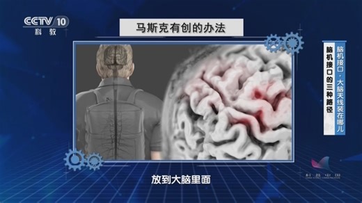 [十分科学]脑机接口的三种路径