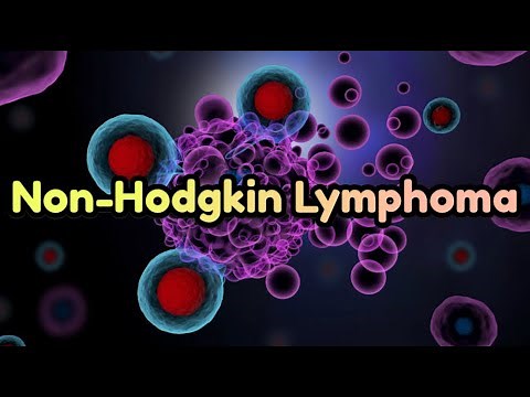 Non-Hodgkin Lymphoma (updated 2023) - CRASH! Medical Review Series