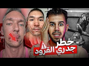 جــدري القرود يهدد العالم, ما القصة ؟